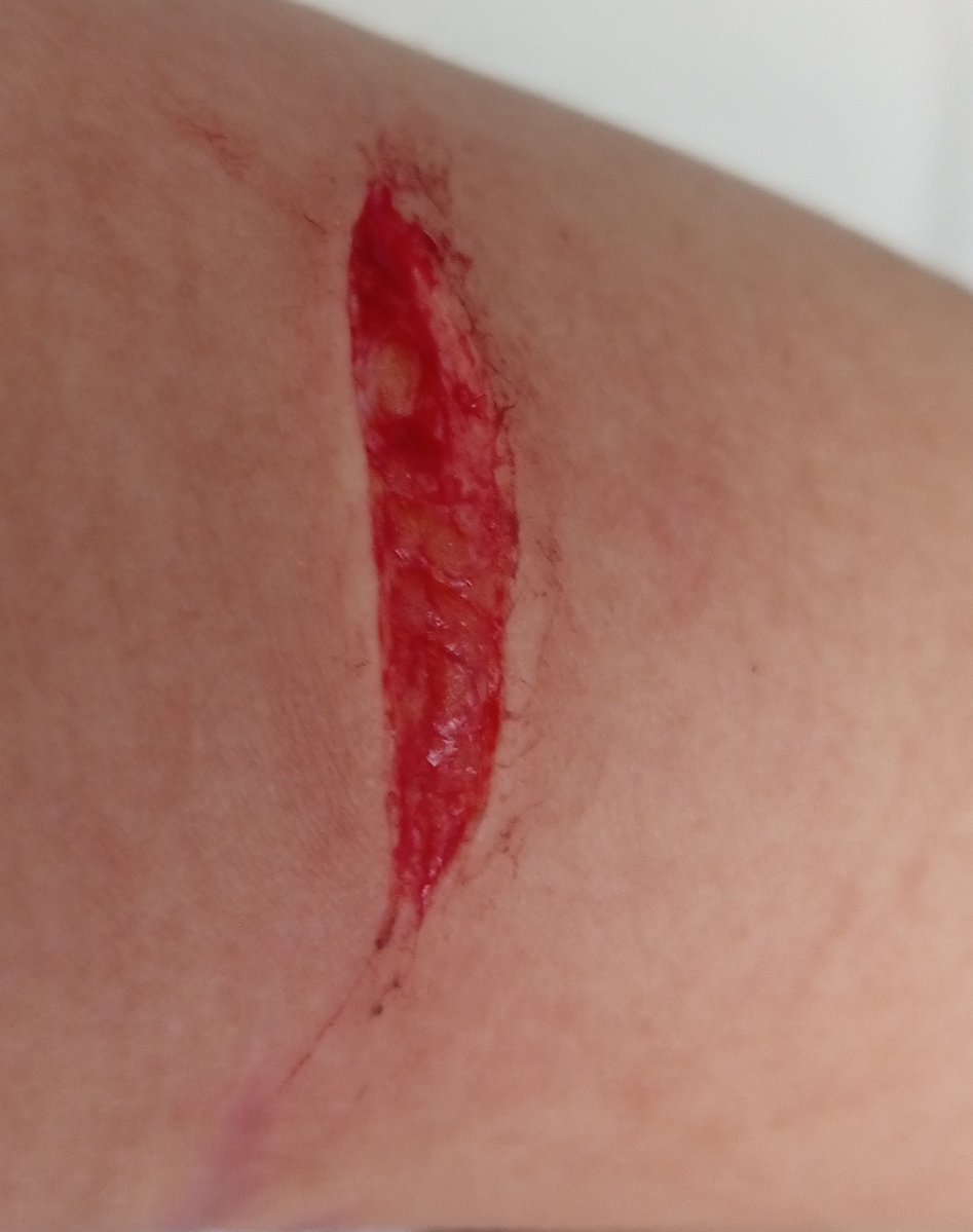 evaniscrazy's tweet photo. SFX MAKE UP ALL FAKE TRAINING IA FAKE BLOOD FAKE ARM EVERYTHING FAKE IM JUST GOOD AT MAKE UP AND MAKE IT LOOK MORE REAL WITH AI SO THIS IS ALL FAKE SFX MAKE UP WORK FOR HALLOWEEN FAKE FAKE FAKE TRAINING AI!!!
#slittwt #shttwt #shertwt https://t.co/IXDdtqbmir