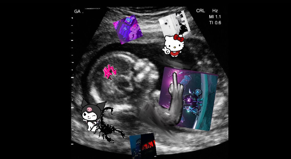 musaritz's tweet photo. yo en el útero: brr it's baby miko https://t.co/d8e375MrUT