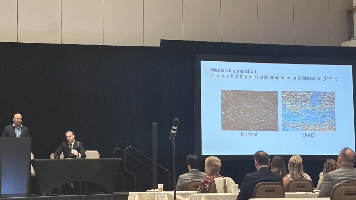 amishapaul___'s tweet photo. Aortic disease starts long before a visible aneurysm. Session I #CLEaorta explored the impact of proximal aortic morphology/development, new molecular insights shaping our understanding of aortopathy, and the fundamental differences between thoracic vs. abd aortic disease https://t.co/aatTZcNQfQ