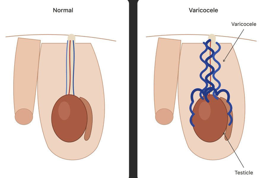 ModReflexion's tweet photo. 3 hábitos de higiene post-s3xo que casi ningún hombre practica.

Cuidar tu salud íntima después del encuentro marca la diferencia (mira el #1): https://t.co/96MIhxx8td