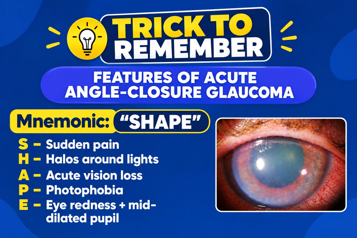 medprep_india's tweet photo. 🧠 A quick mnemonic for rapid revision &amp; exam recall!
#Ophthalmology #Glaucoma #MedicalStudents #NEETPG #INI_CET #MedEd https://t.co/MlYB0upOqw