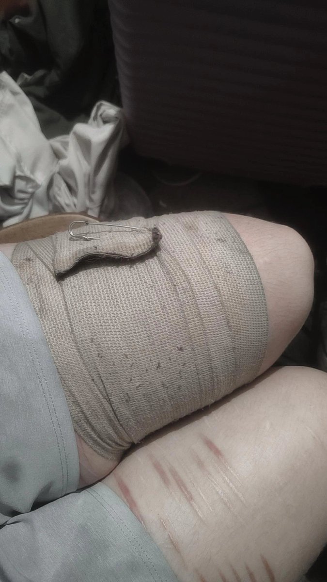 kittymattiee's tweet photo. back in bandage jail... sob sob... https://t.co/onfx1Fnjwa