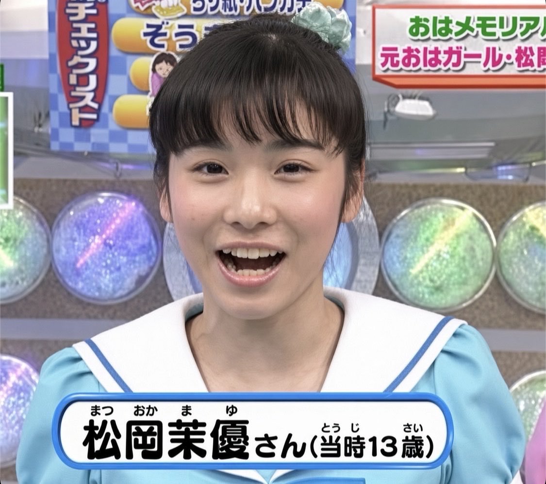 motiva55's tweet photo. 松岡茉優さん、ダウンタイムでの演技力が凄まじくて忘れがちだけど子役時代と比べてどう見ても二重幅が広がってんだよな。

黒目の開きが改善して二重修正、歯並びリアス式海岸も綺麗に港区湾岸の補正されたスマイルアーチに仕上がった。

この変化を見ると小学生に二重整形させるチェーン店とか悪でしかないよね。
