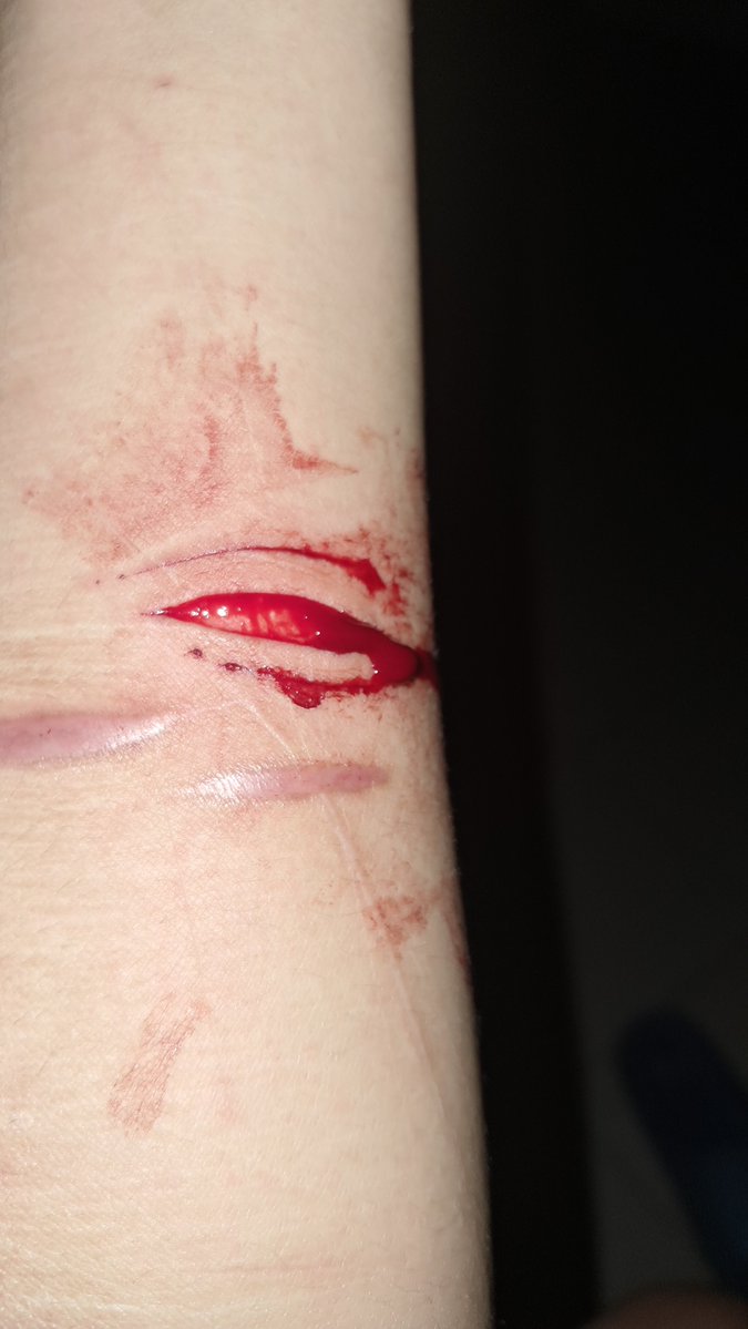bleedlikeboysdo's tweet photo. horror sfx makeup / fake blood https://t.co/JHbMg4eBRA