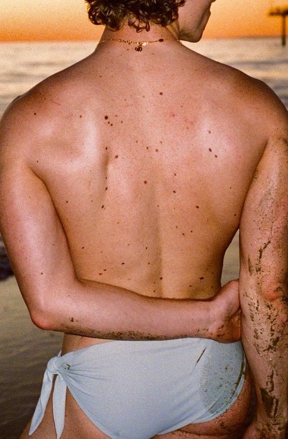 loverrytay's tweet photo. moles….. https://t.co/9lLbbnjXXP