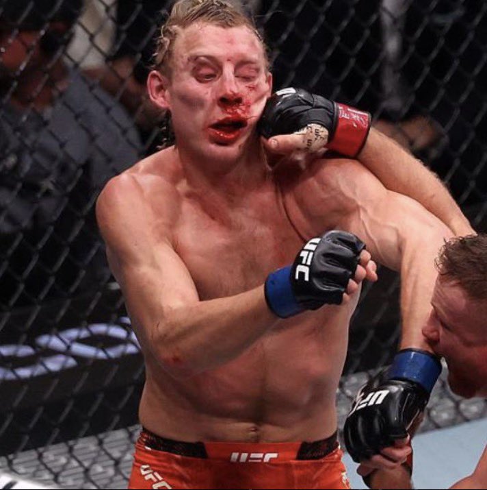 SuperMarioMak3's tweet photo. Everyone give a Big thanks to Arman. Thanks to him we get to watch one of these little germs take another loss and hopefully get koed 
 #IliavsPaddy #ufc #mma #England #Spain #Armenia #USA @Topuriailia @PaddyTheBaddy @Justin_Gaethje @ArmanUfc https://t.co/bh1cUSbGwk