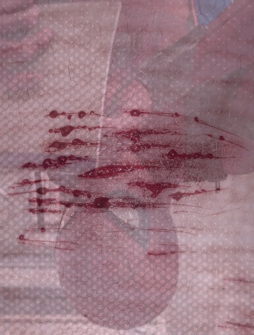 sebpiled's tweet photo. decided to cut some more after posting earlier…too lazy to make this a thread so here u go
bb beans + styros
#shedtwt #shtwt #slittwt #ouchietwt #cuttwt #styros #styrotwt
ai generated, fake everything, nothing shown is real https://t.co/YmHurN3NPv