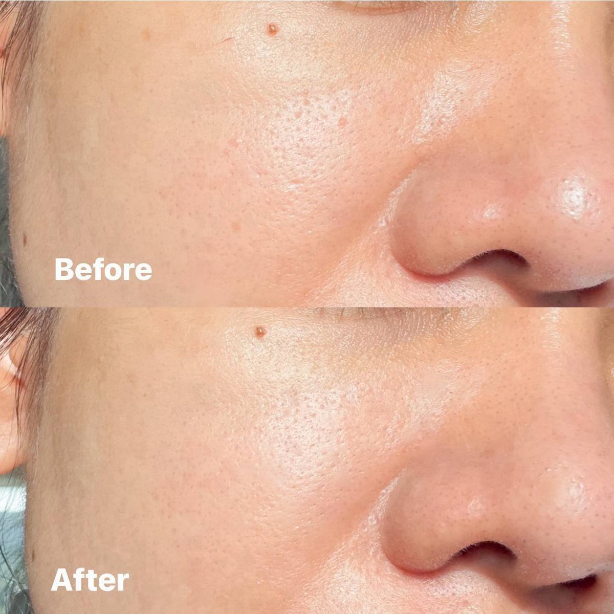 ChaliReviews's tweet photo. ชาวผิวมันมามุง มอยส์เฟรชเจล  La Roche-Posay ตัวนี้ทำมาตอบโจทย์ชาวผิวมันสุดๆ เป็นเอวี่เดย์มอยส์ที่ทั้งชุ่มชื้น แต่ไม่ทำให้ผิวมัน เนื้อเบา ไม่เหนอะหนะ แถมใช้แทนเบสเมคอัพ ช่วยเบลอรูขุมขนได้อีก ทำให้การแต่งหน้าติดท�� ไม่หยา ไม่เยิ้ม เริ่ดเลยละ ไปลองง #LaRochePosayTH https://t.co/FXsYtI9rSj