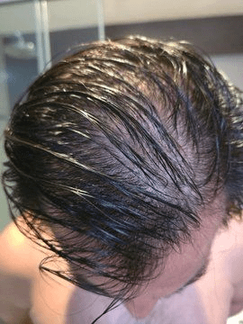 IranaJasmin's tweet photo. Harvard scientists now know how to grow hair back.

By age 35, 2 out of 3 men lose their hair (regardless of genetics). Here are 7 ways to grow yours back (&amp; keep it dark):

1. Your follicles do not die when the hair goes https://t.co/tTu608JKyv