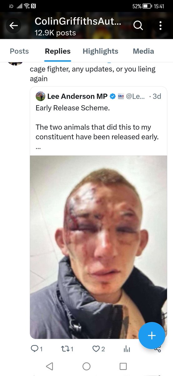 RKBB65's tweet photo. @DaveyNufcFpl @BotFinderUK The only person he's not doing any favours for is Lee Anderson who is the source of this image and as yet, as far as I know, to offer any actual evidence to back his claim. https://t.co/Gbs41VHHYa