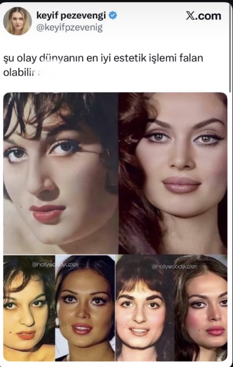 aylin_3506's tweet photo. İyi bir estetik dr u kadınların herşeyidir😂😂 https://t.co/cWl5oVNHiA