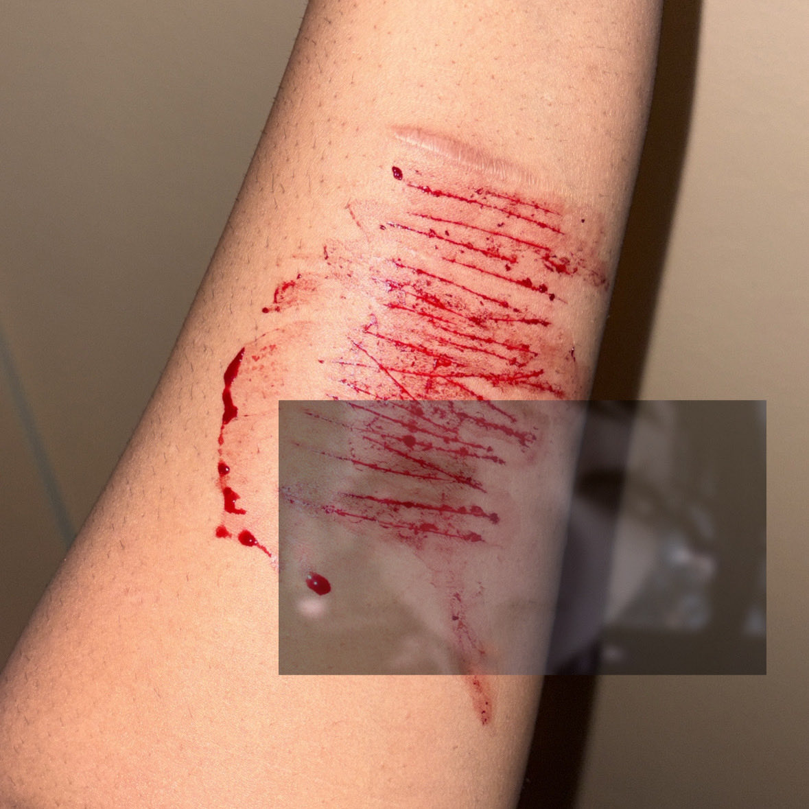 starriesweets's tweet photo. ⭑.ᐟ  repost

⭑.ᐟ ⚠️ ; sfx makeup :p 
• just block, don’t report 

⭑.ᐟ #shtwt #shedtwt #slittwt https://t.co/KtZRoP2bHa