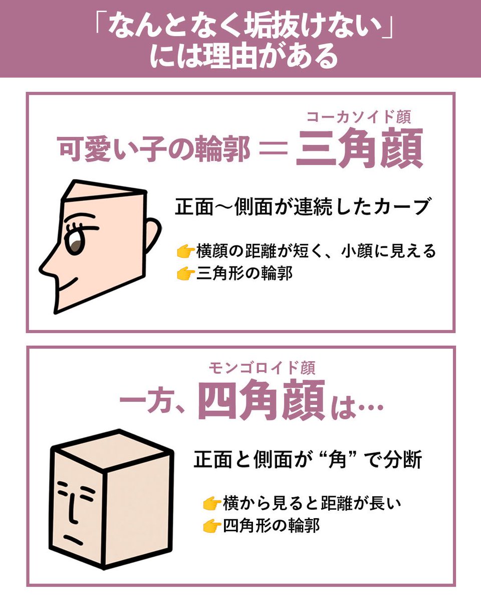babu_yanagawa's tweet photo. ANNAや沢尻エリカも、綺麗な人は大体
"三角顔"👱🏻‍♀️

我々モンゴロイドは四角顔だけど、綺麗な人は必ずコーカソイドの要素を持ってる。

四角顔→三角顔にするには、

❌骨切りしかない
⭕️脂肪吸引で可能

頬骨上の、"チークボーンファット"をデザインして削れば、"角"がなくなり、三角顔に近づく💡

頬骨骨切りまではしたく無い人や、骨切りしたけどあまり変わらなかった人は、是非
"チークボーンファット"を試してみて👍