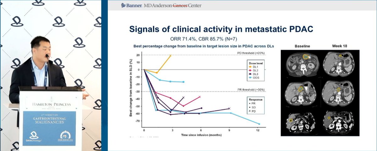 DAVAOnc's tweet photo. At #DAVAGI, Dr. Zachary Yeung @BannerHealth discusses NT-175, an engineered TCR targeting TP53 R175H, with activity in PDAC. TP53 R175H is reported in 4.2% of PDAC, and a 57% decrease in tumor burden at 3 months was observed. https://t.co/UcwzgS3aoN