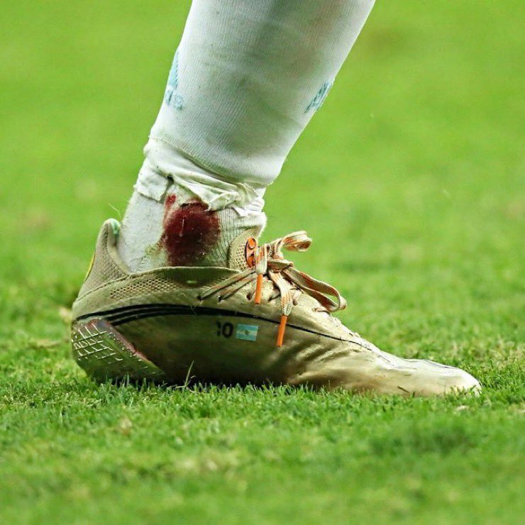 Messifangirl99's tweet photo. That’s not Messi’s foot

That's a warrior who refused to quit. https://t.co/A7sZykAXMS