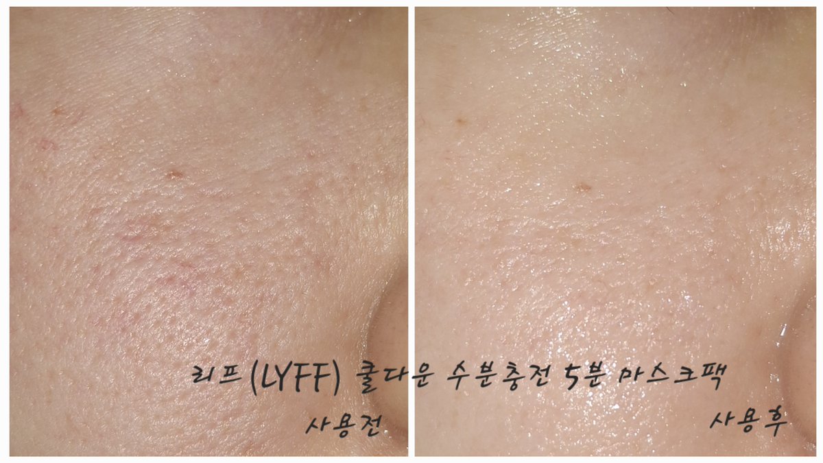 beryl719's tweet photo. #제품제공  #체험단
✅️리프(LYFF) 쿨다운 수분충전 5분 마스크팩
(@LYFFKR_ )

피부 온도를 낮추는 쿨다운 스킨팩!

항상 토너패드5~6장씩 붙이곤 했는데 이제는 단 한장으로 편하게 사용할수 있어 특히나 더 좋았던 리프 5분 마스크팩! 

(이어서) https://t.co/MLTMdgrLKo