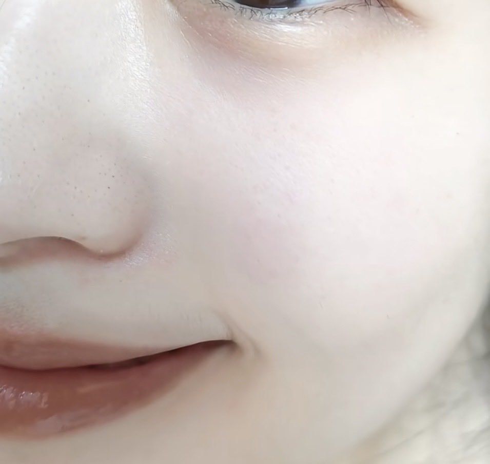 _____ioq's tweet photo. 秒でニキビと毛穴消えて横転。インナードライと皮脂ドバには圧倒的にこれ https://t.co/aWLB9ZJBJ2