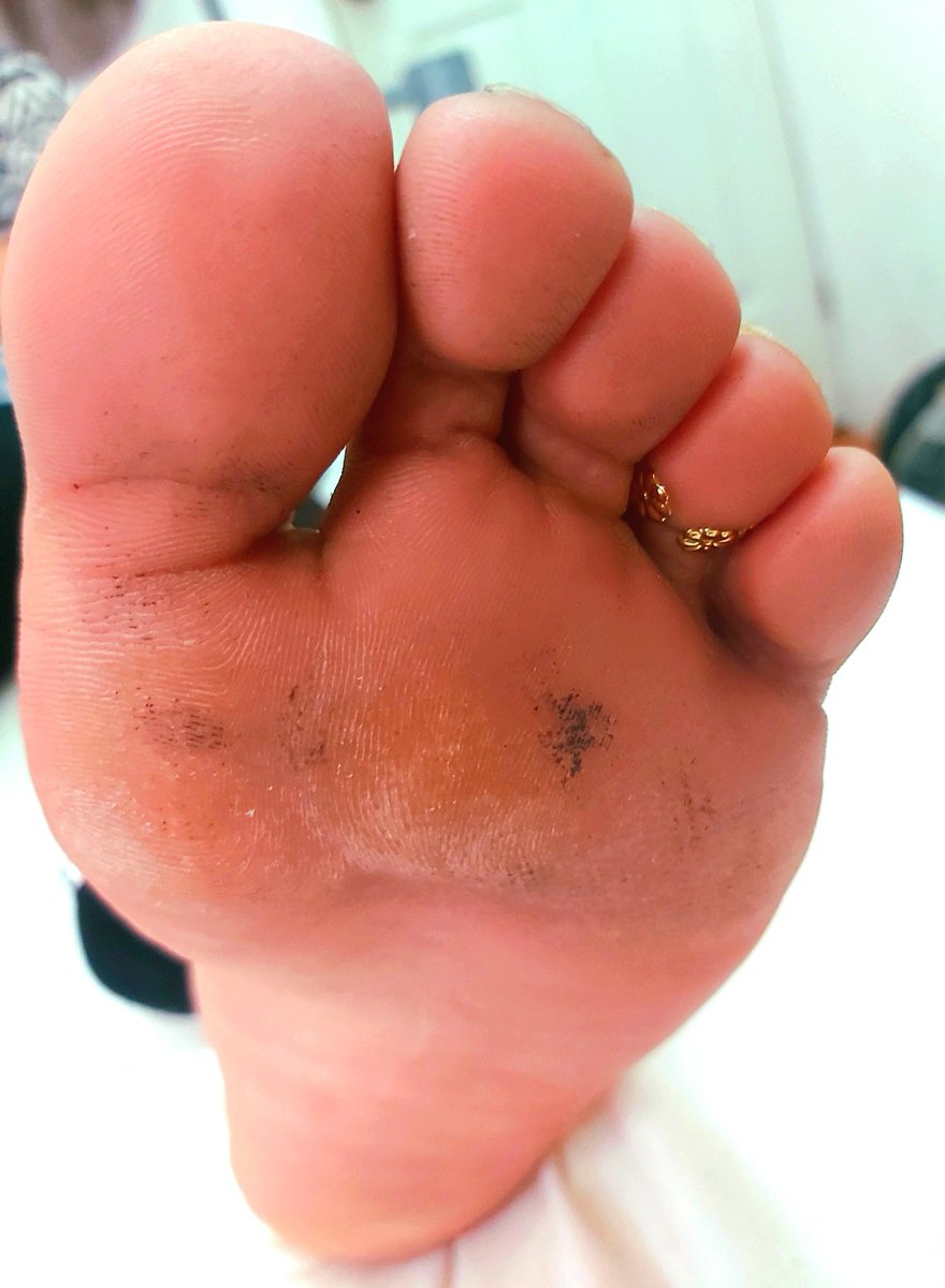 LiCuteUwU18's tweet photo. Una fotito de la patita de mi gordita preciosa (osea mi novia) me dio permiso de publicarla uwu 💕 

Amo cuando las tiene sucias, yo se las limpio con mi lengua 😝 💗

#footfetısh #feetfetıshly #feets #soles #dirtyfeets #pies #patas #latinafeets #solesandtoes #sexy https://t.co/C8LvhRivUN