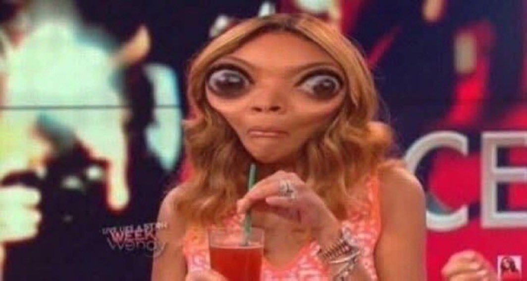 SyrCassian's tweet photo. @svhibe “To his credit, sheeran seen here looking at both sides of the issue” 
*shows a picture of ed sheeran looking at both directions at once* https://t.co/aMDKPYx5Jv