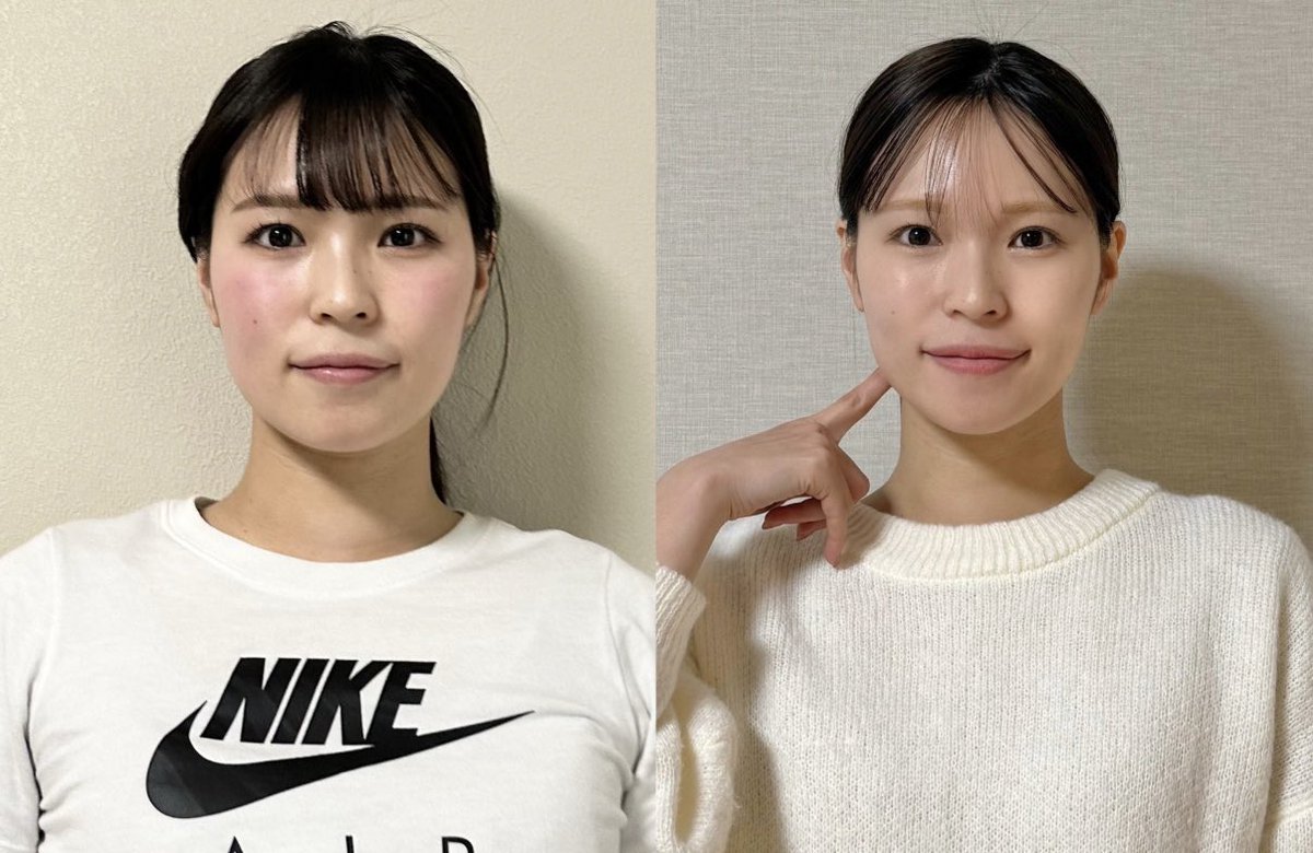 torepina_diet's tweet photo. これ顔痩せるだけじゃなくガチ垢抜けてて凄い、、 https://t.co/wD6Ik6TiNn