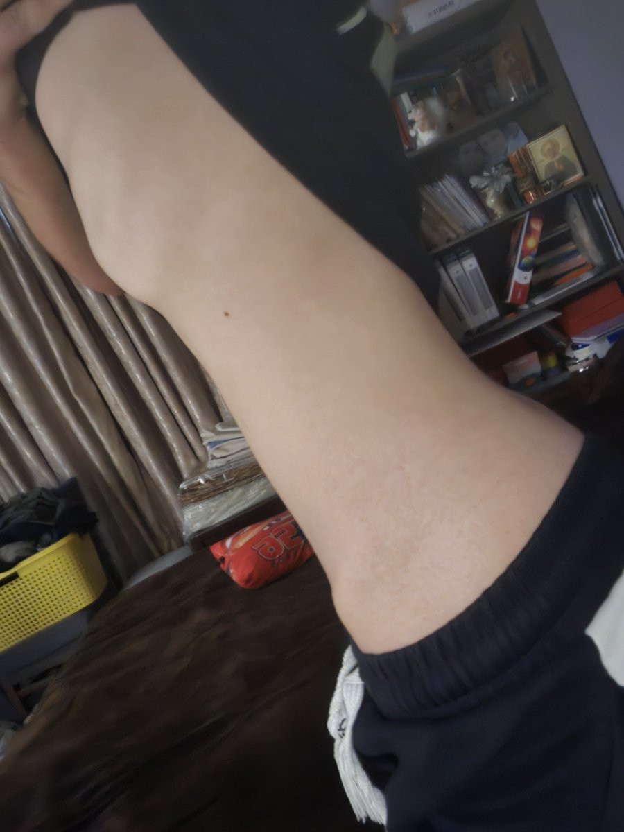 Barachielitry's tweet photo. Im so fucking bloated today omfg  #shedtwt #estate #shtwt https://t.co/zg0ANe7XAj