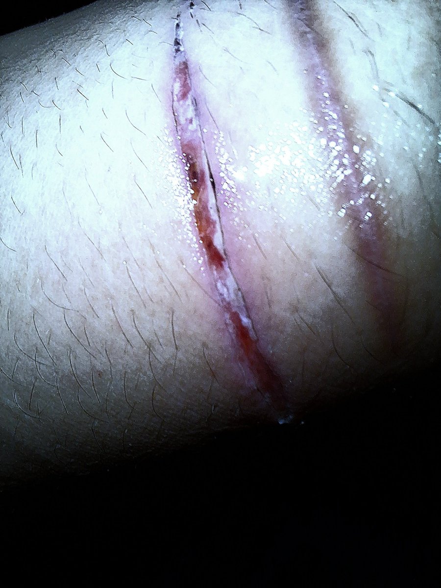 plskillyuorself's tweet photo. realistic depiction of injury for medical purposes. ALL FAKE, IT'S MAKEUP. MADE WITH AI. #sfx #makeup https://t.co/4p5hej830z