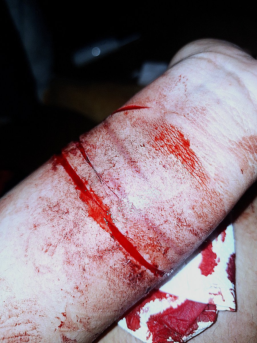 plskillyuorself's tweet photo. realistic depiction of injury for medical purposes. ALL FAKE, IT'S MAKEUP. MADE WITH AI #sfx #makeup https://t.co/iKMf6F6C2E