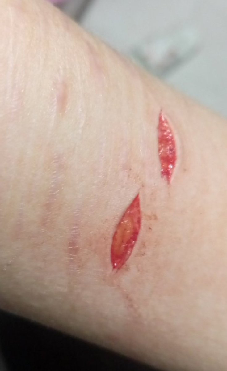 evaniscrazy's tweet photo. ALL FAKE SFX MAKE UP FOR HALLOWEEN ALL FAKE THIS IS FAKE BLOOD FAKE ARM I DO THE SFX MAKE UP AND MAKE IT LOOK MORE REAL WITH AI TRAINING AI ALL FAKE FAKE FAKE THIS IS NOT REAL!!
#slittwt #shttwt #shertwt 
Old ones so tiny so cute https://t.co/U6aiE1iVYr