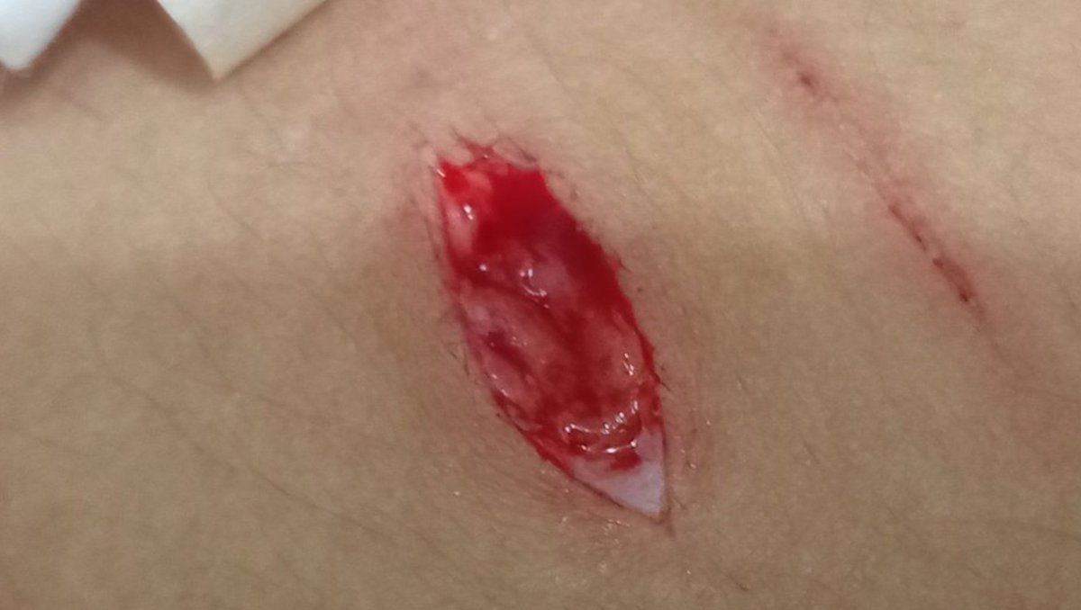 evaniscrazy's tweet photo. ALL FAKE SFX MAKE UP FOR HALLOWEEN ALL FAKE THIS IS FAKE BLOOD FAKE ARM I DO THE SFX MAKE UP AND MAKE IT LOOK MORE REAL WITH AI TRAINING AI ALL FAKE FAKE FAKE THIS IS NOT REAL!!
#slittwt #shttwt #shertwt 
Old ones so tiny so cute https://t.co/U6aiE1iVYr