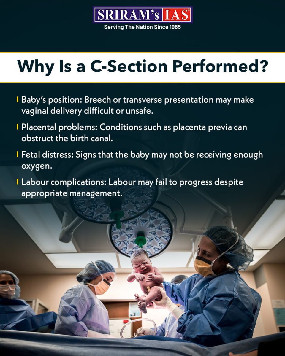 sriramsrirangm's tweet photo. What is C-section?

Why it is in the news? https://t.co/c8FUKgKvk9