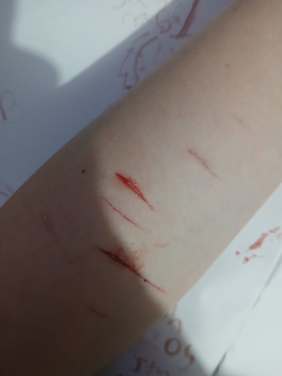 misothegoat's tweet photo. @divasipincup All fake sfx makeup totally not real https://t.co/thGncjIe7V