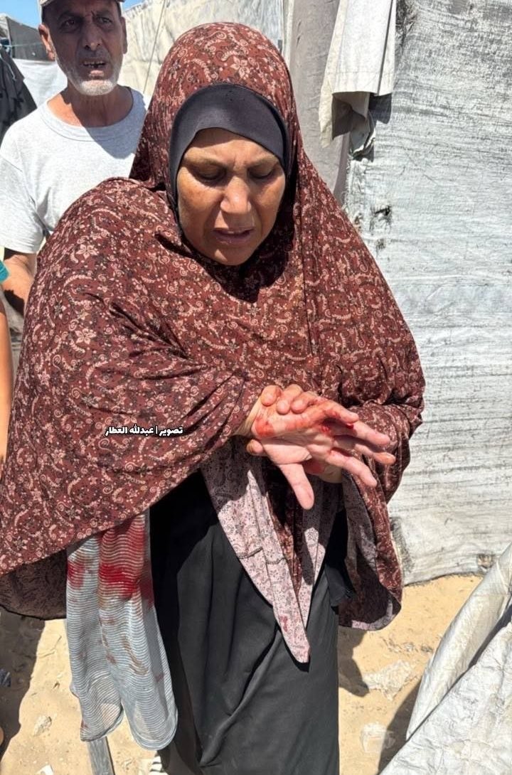 gazanotice's tweet photo. 🚨BREAKING: A Palestinian woman was injured and damage was reported after Israeli shelling targeted tents sheltering displaced families west of Khan Younis in southern Gaza Strip .