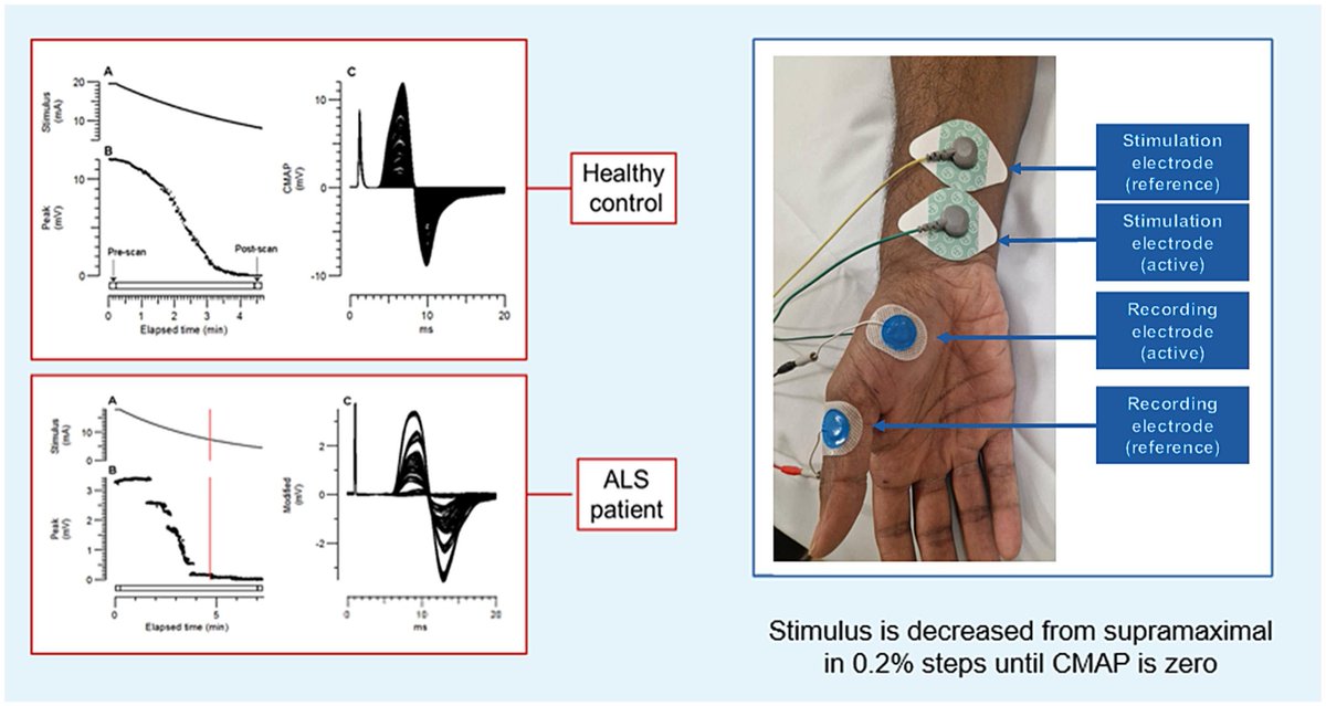 ClinicalNeuroph's tweet photo. [Neuromuscular system: IFCN handbook] Tankisi et al.: "This review shows the rich variety of methods used to study peripheral nervous system." https://t.co/znNRiMHBfP https://t.co/9VloqULsGQ
