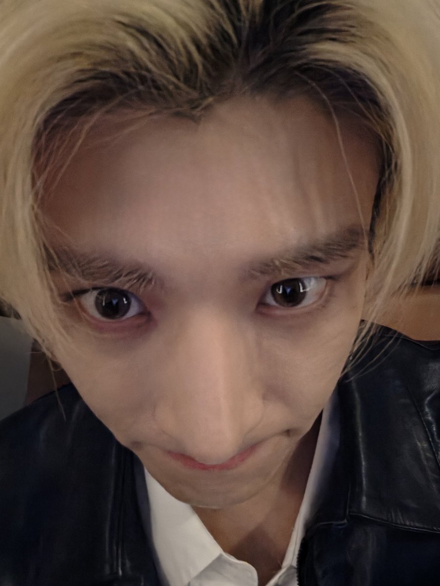 ridetosolarr's tweet photo. baru kali ini ngelihat idol semanja ini ke fans nya 😭😭 bahkan tangannya kena luka aja dia ngelapor…..

wajahnya 🥺             TANGANNYA 🥺🥺🥺 https://t.co/ghPCw72bbv