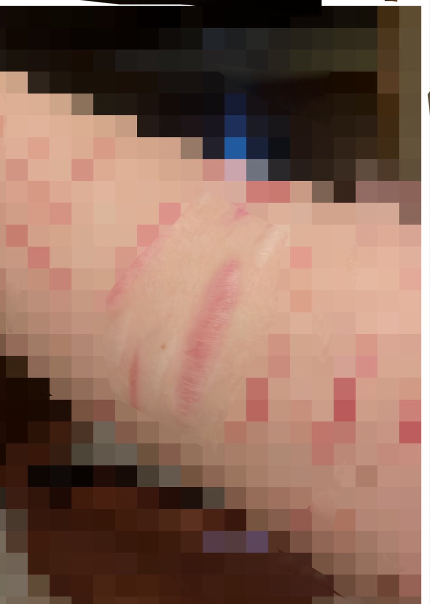 junnio_08's tweet photo. bean cvt vs scar
makeup sfx practice
#ouchietwt #shrtwt #988twt #slittwt https://t.co/wsrefAvvON