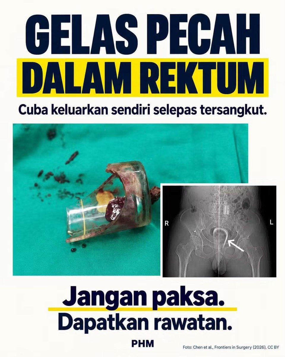 put33ri's tweet photo. Berita apakah iniii.. hahaa https://t.co/1NtSes0A0o