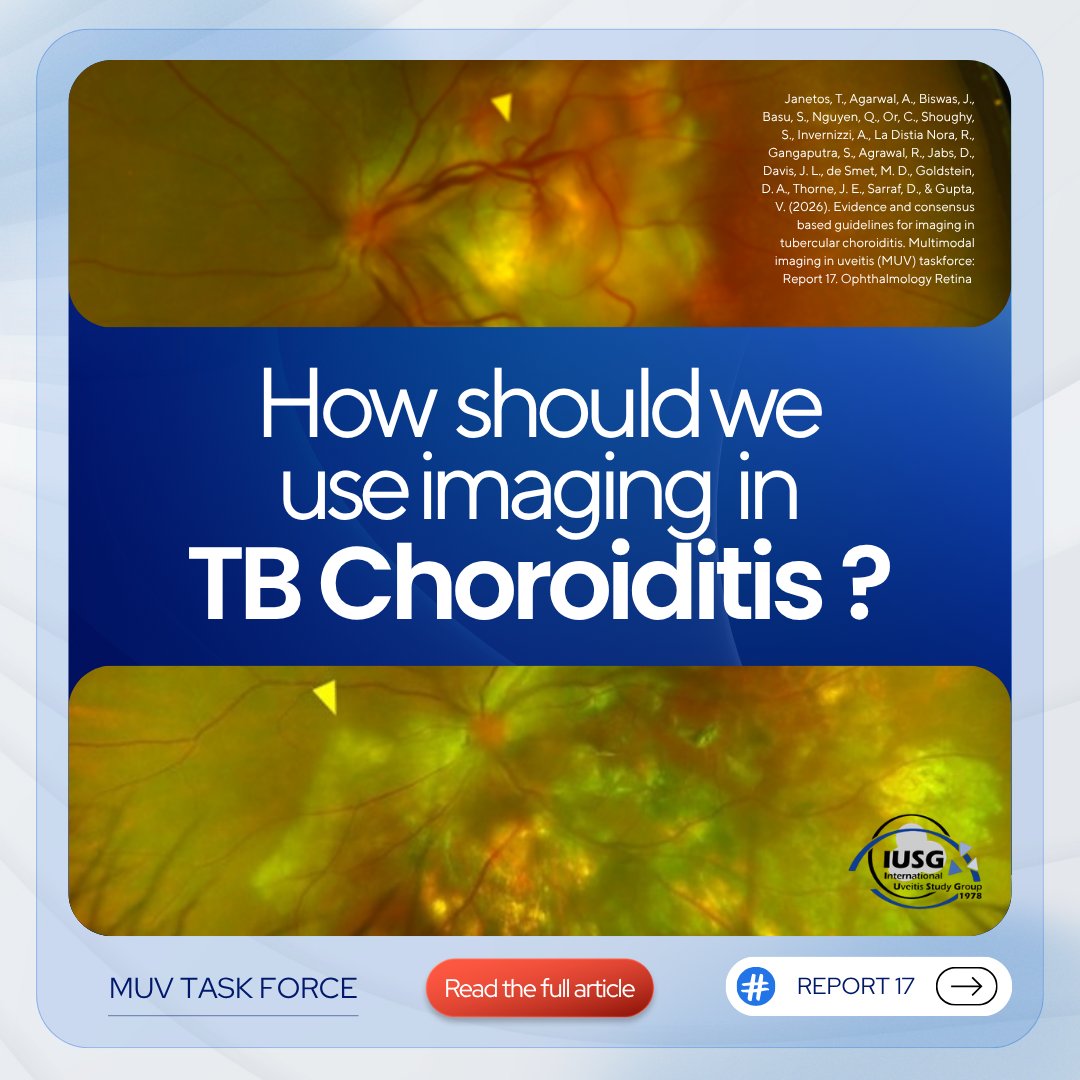 iusg_official's tweet photo. The Multimodal Imaging in Uveitis (MUV) Taskforce has published Report 17: Evidence and Consensus-Based Guidelines for Imaging in Tubercular Choroiditis, now available in Ophthalmology Retina.

https://t.co/moHf769WLh

#IUSG #MUVTaskforce #multimodalimaginginuveitis https://t.co/ydmc8790Rx