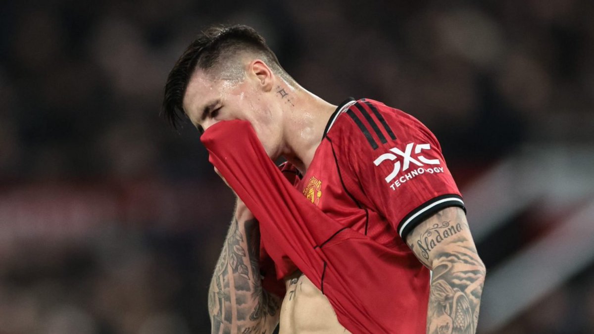 AliceTalksFooty's tweet photo. Sesko could be out for a while again... but it's fine INEOS  signed a new ST this summer like Carrick wanted.

Oh wait they didn't... 
Going into a 60 game season with one young injury prone ST and a one old Injury prone LB.

Great squad planning from the #BestInClass INEOS again!