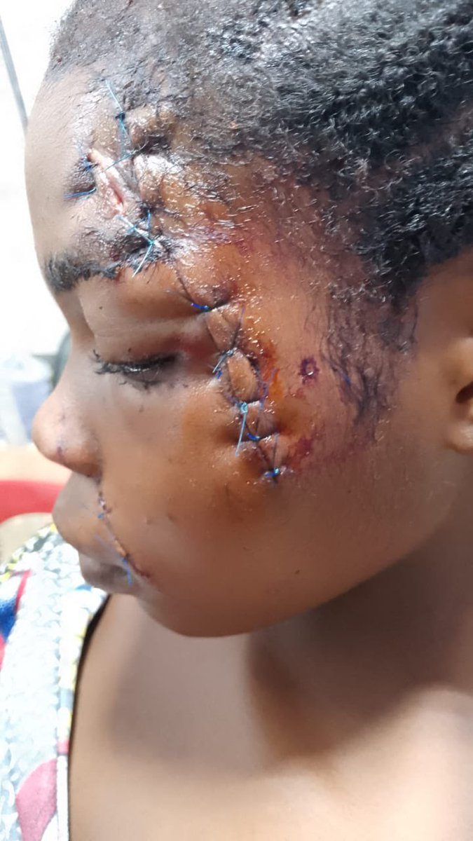 VictorManjul's tweet photo. Within the last 7 days, I visited three communities that have been victims of the ongoing Fulani attacks in Plateau State. 

One common complaint or testimony across all four communities is: “The Nigerian Army has arrested, and will arrest and detain any native seen with anything that looks like a weapon they can use to defend themselves against the Fulani killers.”

How then does a community with nothing to defend themselves survive the invasion of 10-30 Fulani terrorists, armed to the teeth with AK-47s?

“They are stupid” 
“They are not ready”
“How long before they rise up”
“They should stand & defend themselves”

We sit at the comfort of our homes criticizing, insulting and advising Victims on what to do!

Yet, we have no idea what they're going through daily, and the efforts they've made to keep themselves alive 

There's more to the dead bodies and crying out in pain we see on TV and social media⚠️‼️

There's a lot more evil going on, only the Victims and those around them can understand!