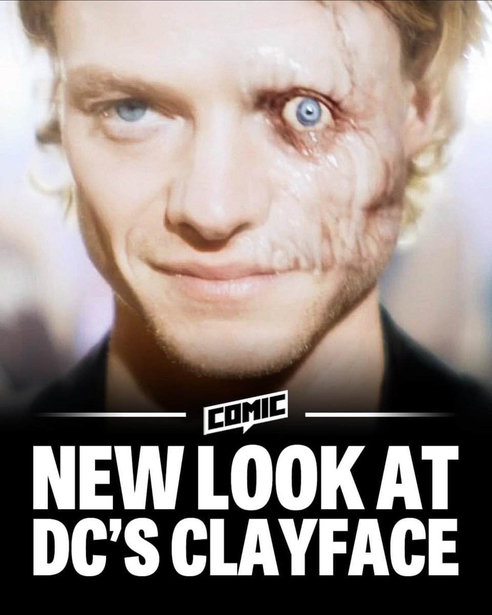 EFCWGLY's tweet photo. i dare david moyes to have a stinker https://t.co/ly8O9Lmxmo