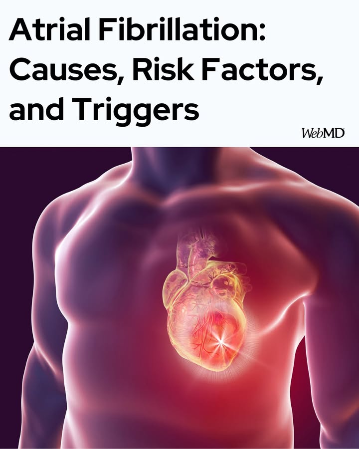 WebMD's tweet photo. AFib (Atrial Fibrillation) is a common heart rhythm condition—but knowing its causes and triggers can help you manage it better. From high blood pressure and heart disease to stress, alcohol, and poor sleep, many factors can play a role. https://t.co/j1pJ0yxto9 https://t.co/iSM6SKksjY