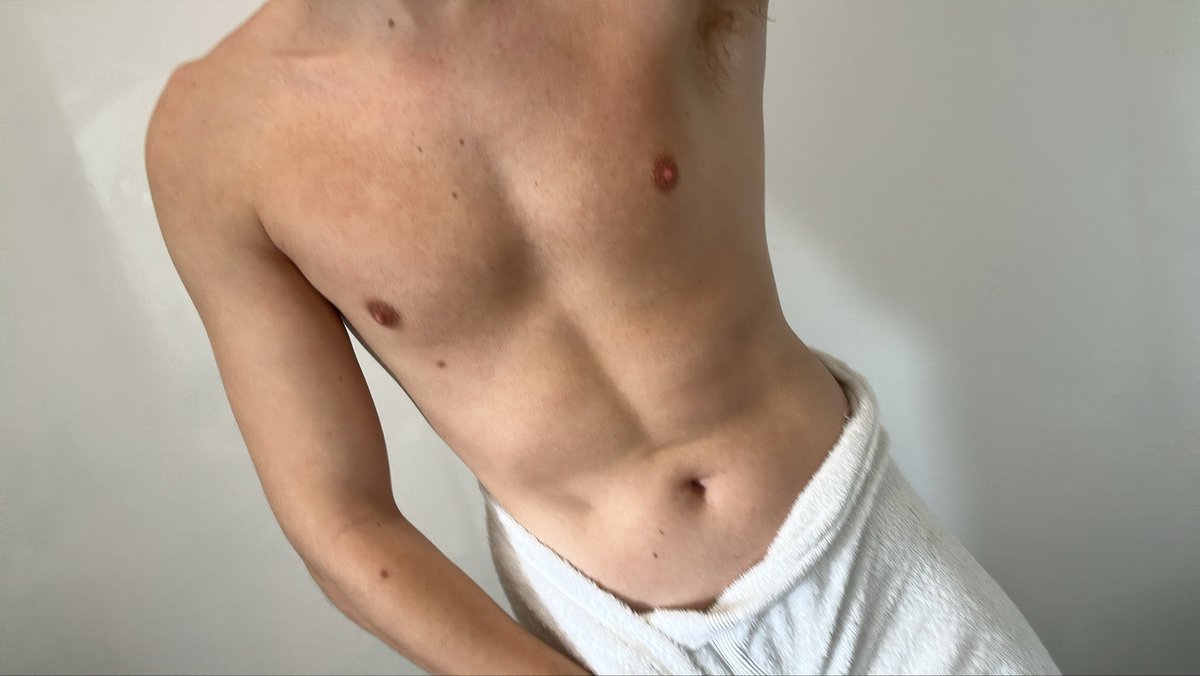 JohnnoTheBoy's tweet photo. Want to see me drop the towel? 🙈 #twink #gay https://t.co/jtA63XoYc6