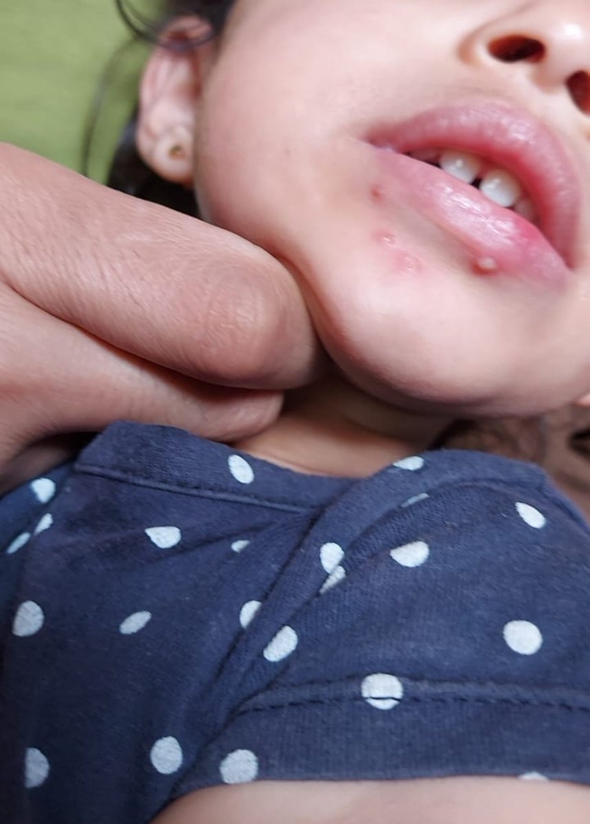 rola_almoghrabi's tweet photo. Unfortunately, no one cares 😭

︎
︎

︎

︎

︎

︎
︎

︎

︎
︎

we’ll remind you
︎

︎

︎

︎

︎
︎

︎

︎

︎

︎
︎

︎
︎

︎
︎

︎

︎

︎
︎

︎
that
︎

︎

︎

︎

︎

︎
︎

︎

︎

︎

I desperately need food and medicine for my baby😭 
https://t.co/FLk3iM7URh https://t.co/qXSo2ogLAq
