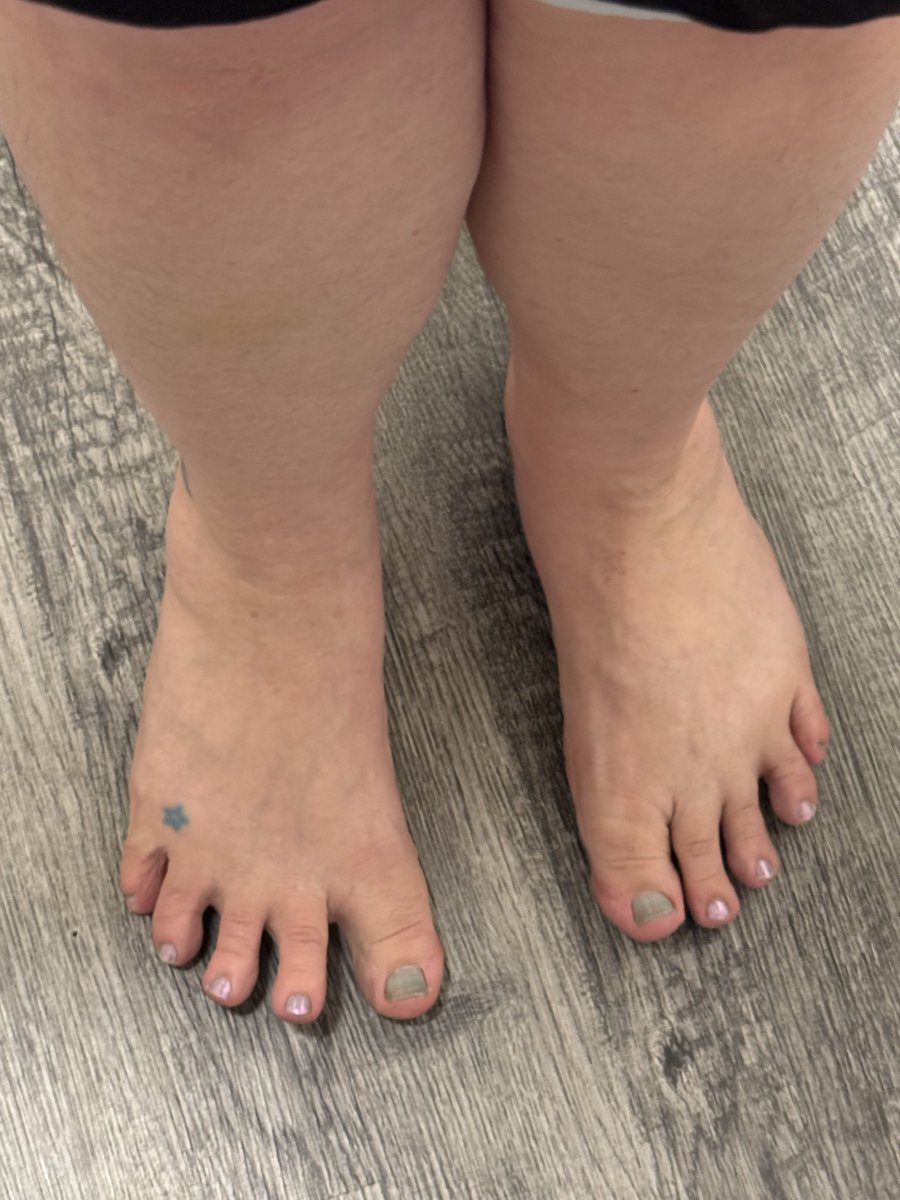 ceemyfeet69's tweet photo. A little dirty after a barefoot walk #dirtyfeet #barefoot #maturefeet #dirtysoles #soles https://t.co/yk7KWJV1iu