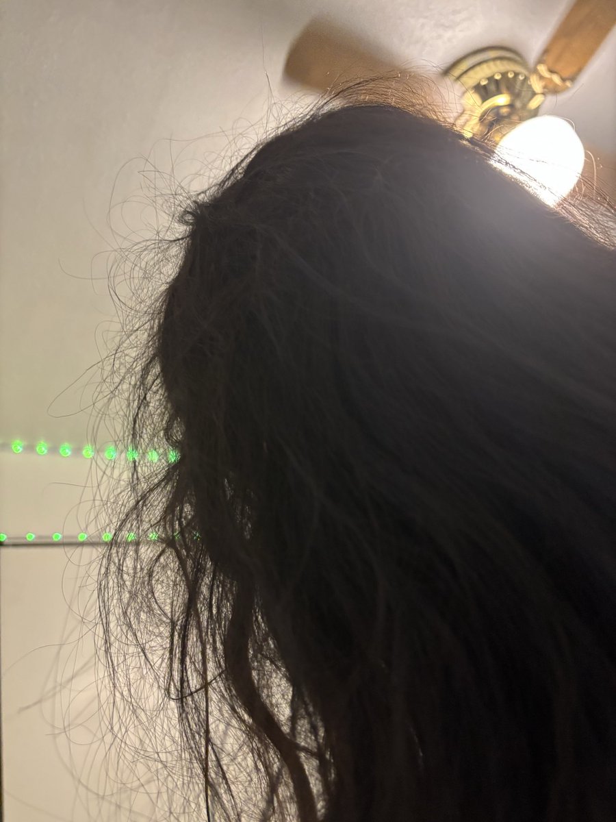 Inkyhydra99's tweet photo. @inouesimp Its the most normal shit, pic of me side ways male btw https://t.co/VYKWRzkz9l
