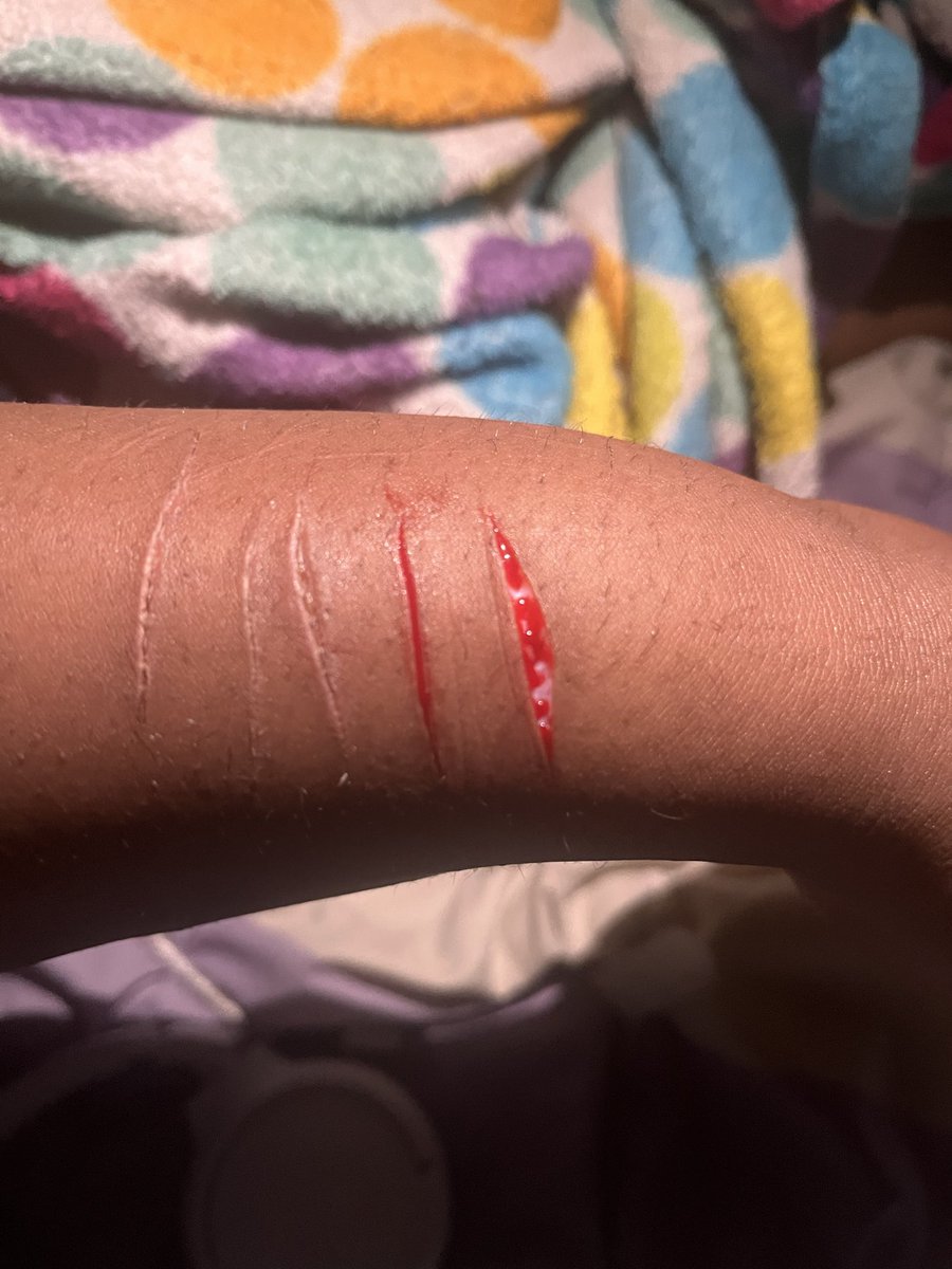 MariZtragic's tweet photo. SFX makeup ai #styro #cuts #sh #shtwt #pain https://t.co/O65dddOc3x