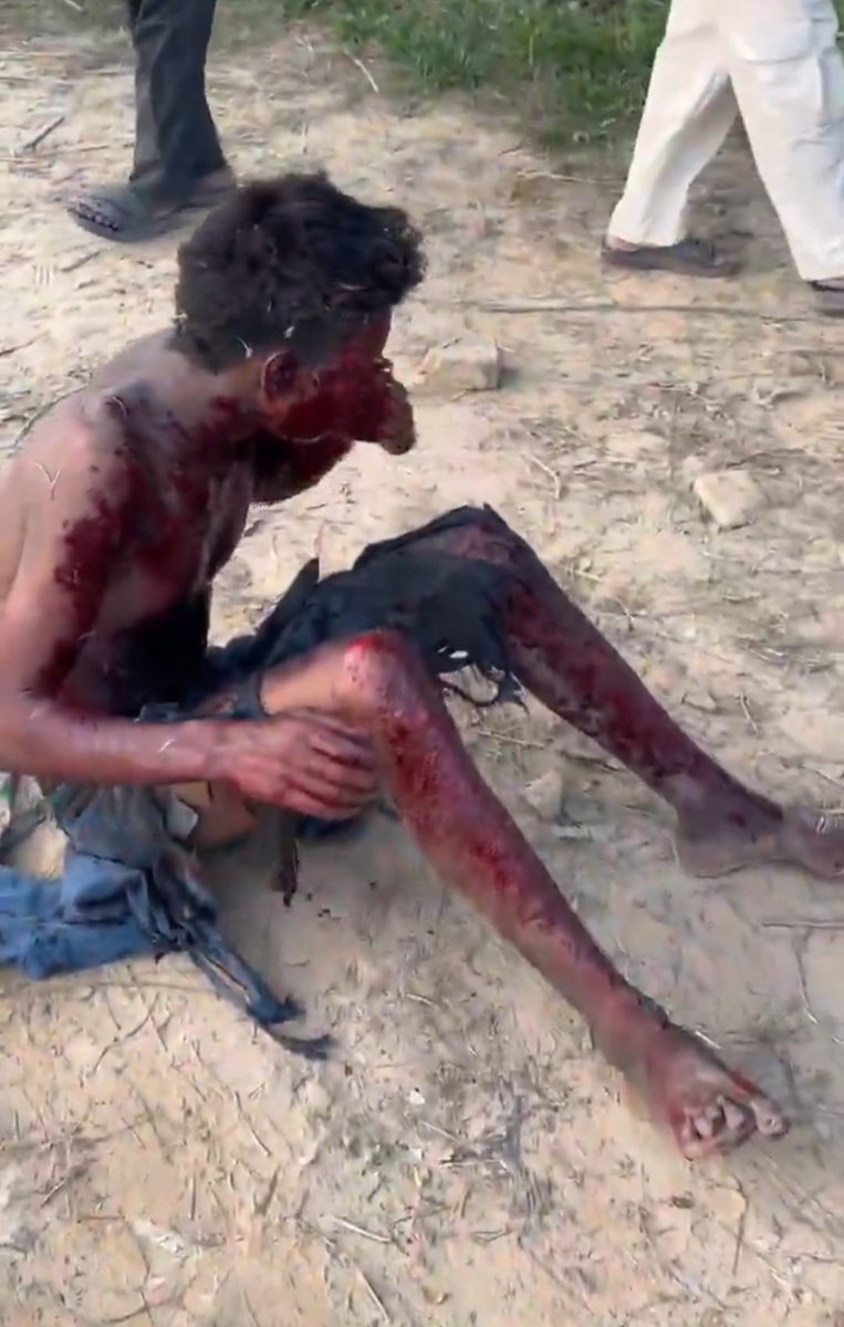 thenation91's tweet photo. बिजनौर : दहल उठा शेरकोट! 
​पटाखा फैक्ट्री के कचरे में हुए बम जैसे जोरदार धमाके से बिजनौर सहम गया। हादसे में 2 लोग गंभीर रूप से घायल। पुलिस जांच में जुटी 🚨
​@TheNation91 @bijnorpolice
​#Bijnor #Sherkot #BijnorNews #BreakingNews #TheNation91 https://t.co/KKx8CDuJSi