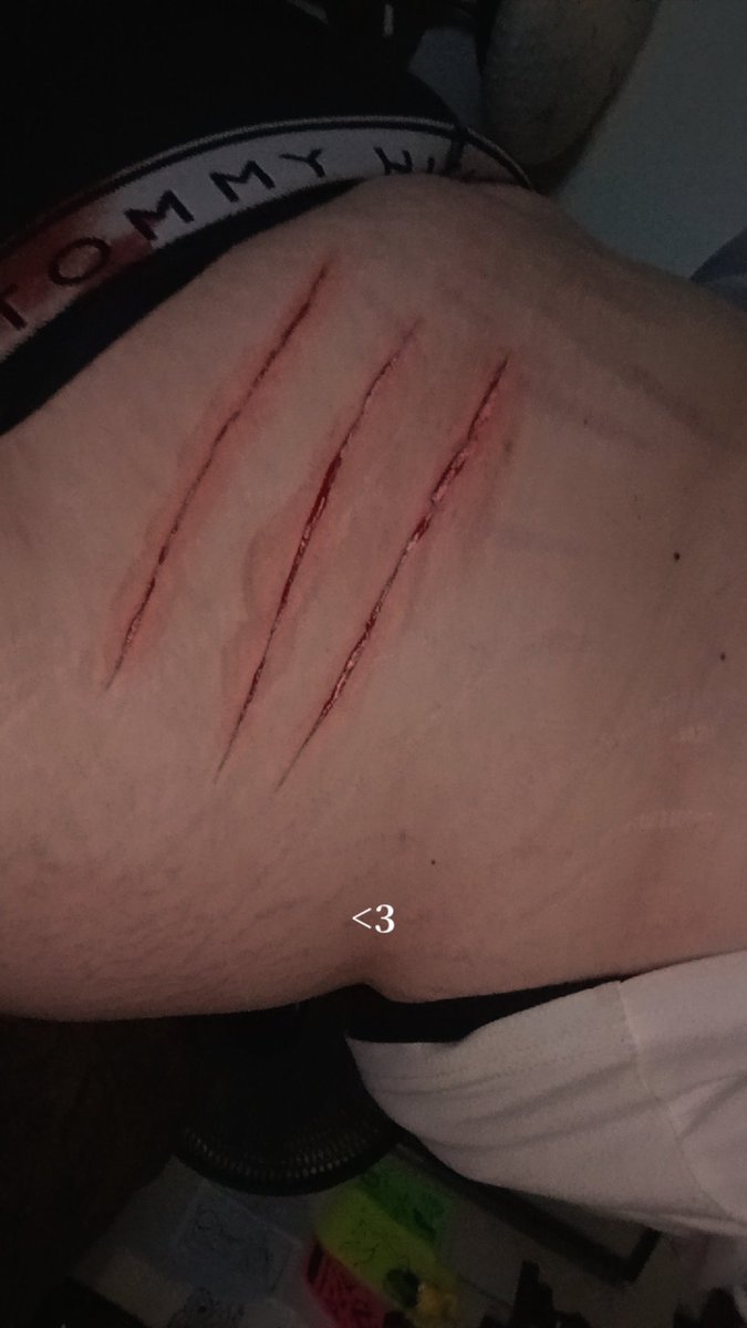 vamp_scars's tweet photo. sfx makeup #fake #sfxmakeup #shtwt #shedtwt #988twt #bloodtwt All fake, fake makeup! Fake body! https://t.co/FhHT6fYNOy
