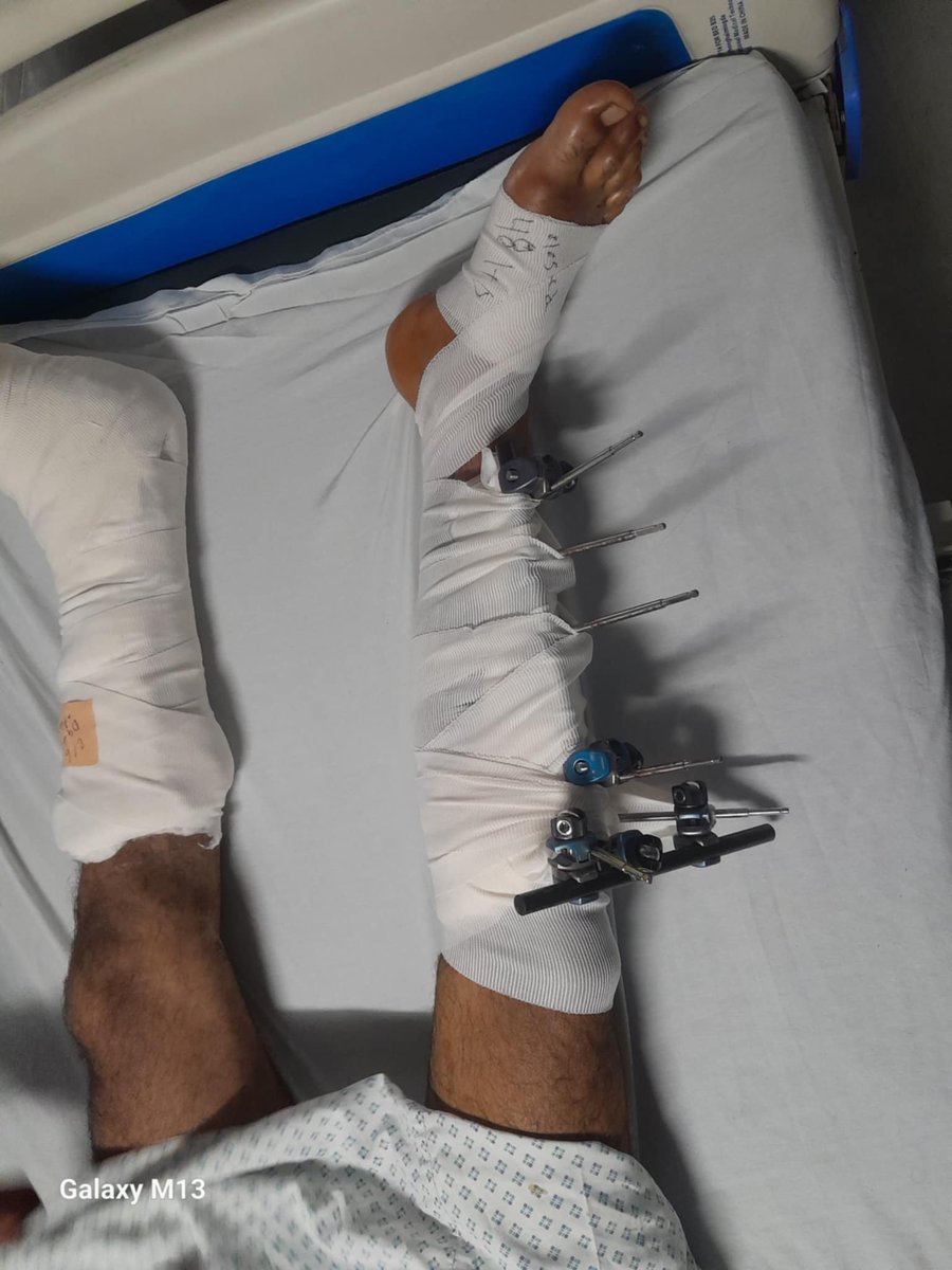 SAlmsry38871's tweet photo. I am Sanad from Gaza, and I urgently need surgery. The cost is $700.
I need your help to cover the cost of my operation. Any donation, no matter how small, can make a big difference in my life. 🙏💔
Please help me. Thank you from the bottom of my heart.
https://t.co/TMaNkazR7Y https://t.co/xRkrvaS5dX