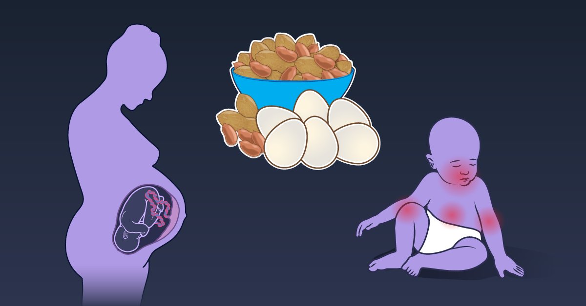 Illustration showing a silhouette of a pregnant person with a fetus visible inside, a bowl of peanuts and eggs, and an infant with red rash marks on the skin from a food allergy.